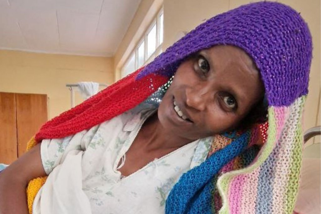 Fozia POP | Catherine Hamlin Fistula Foundation | Together we can eradicate obstetric fistula in Ethiopia.